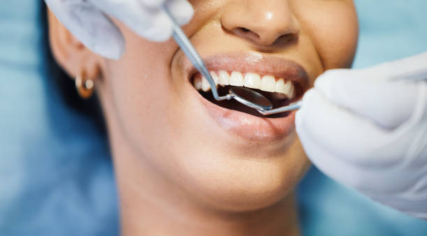 Best Knocked-Out Tooth (Avulsed Tooth) Treatment in Senoia, GA